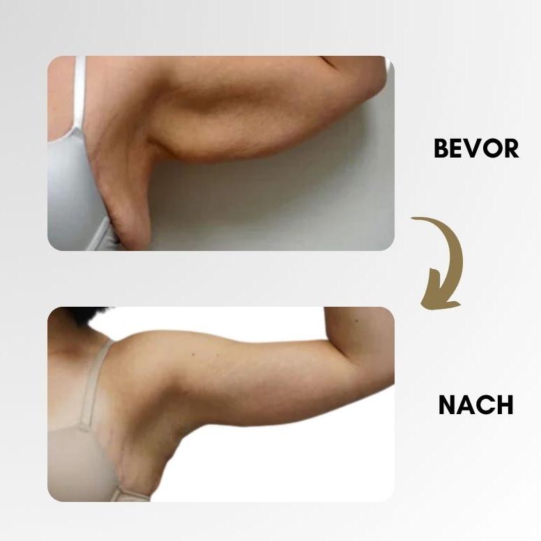 LymphBoost Fettverbrennende Entgiftungsergänzungspillen - Livezo